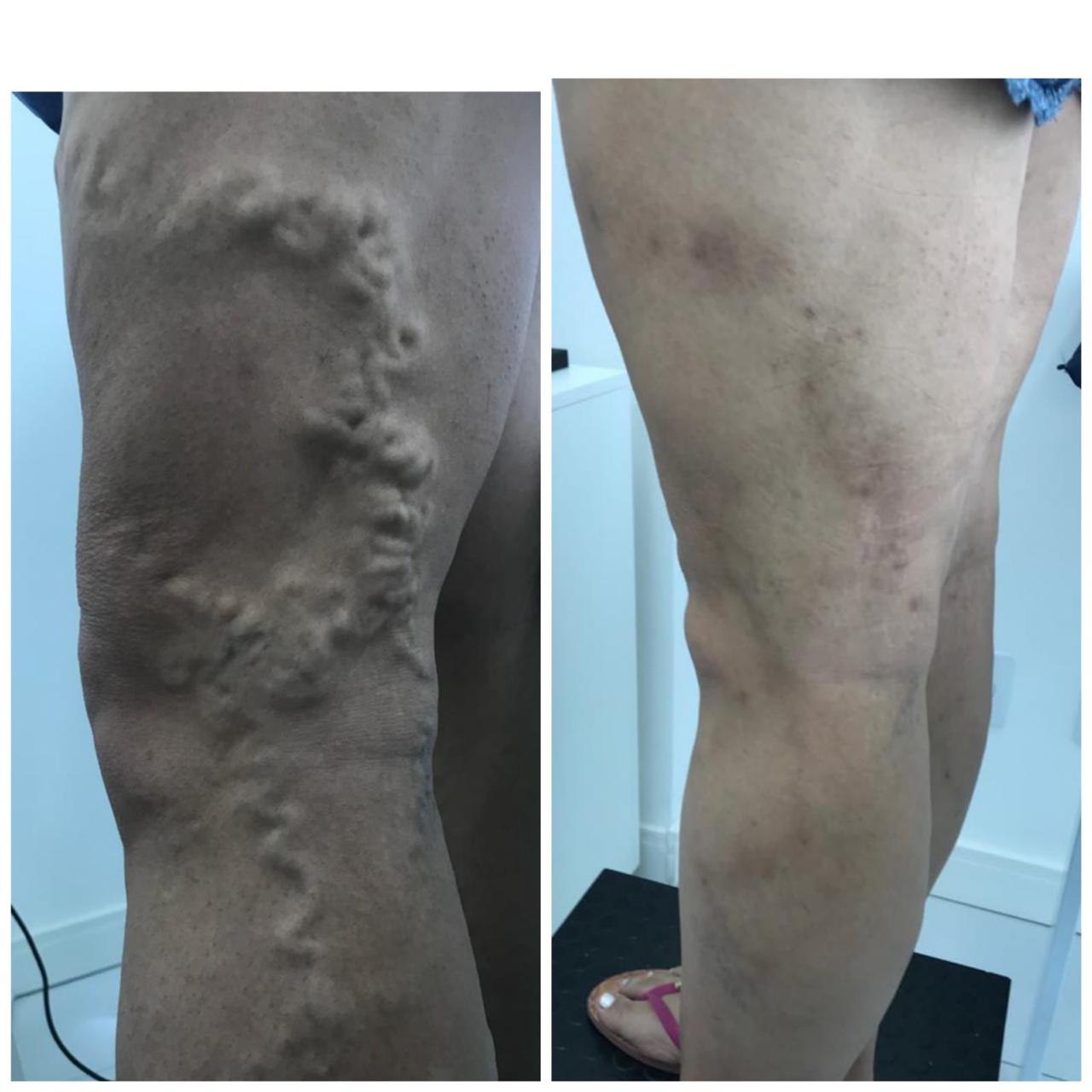 Antes e depois — paciente 01