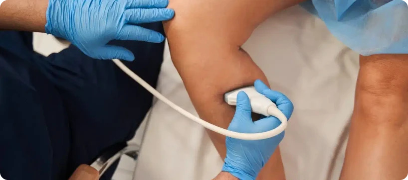Ecodoppler Vascular